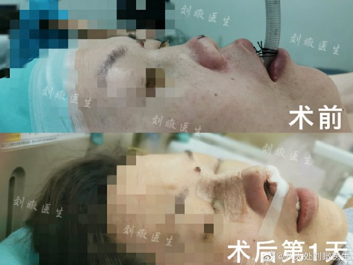 刘暾鼻综合案例
